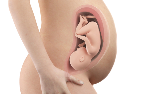 O chute do feto que tenha quebrado o útero da mãe